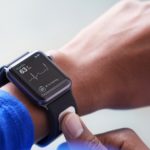 Apple WatchとAliveCor EKG techウォッチバンド、カリウム＆心房細動の検出が可能